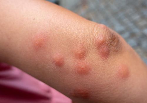 【網購傢俬注意】淘寶傢俬送床蝨!? 滅蟲專家：9成淘寶木傢俬有蝨蟲! 拆解6大成因＋防蝨步驟 - 2