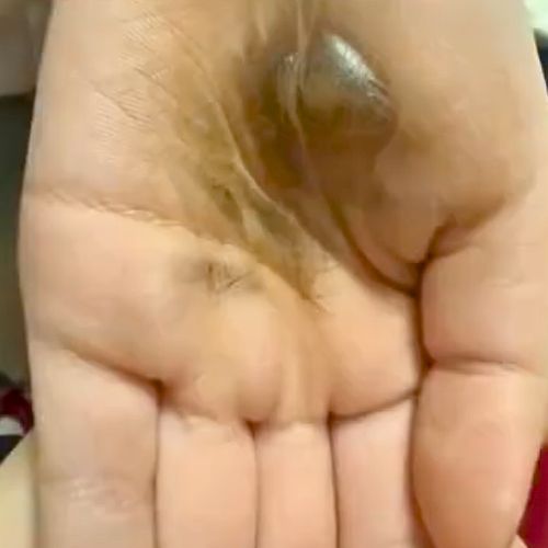 【浴室吹頭】風筒突然著火爆炸 女子手部遭炸黑燒傷 專家揭3大致命習慣 九成人都做錯 - 4